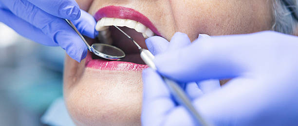 Best Emergency Cosmetic Dentistry (e.g., broken veneers) in Burien, WA